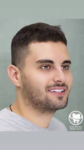\"\"