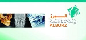 رادیولوژی دندان ، فک و صورت البرز 