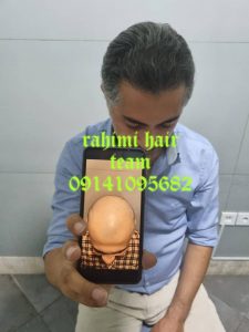 \"\"