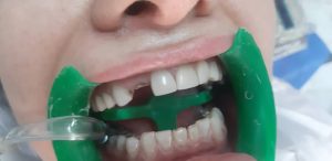 \"\"